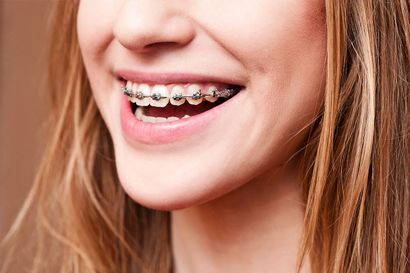 Orthodontics in El Paso